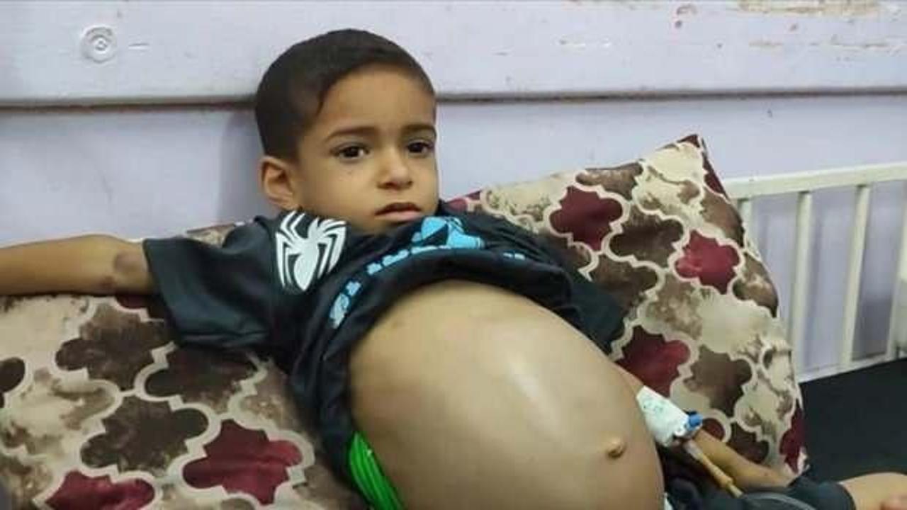 Gazzeli Emin tedavi olmayı bekliyor